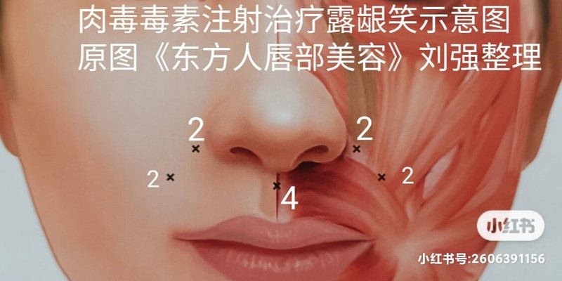 圖文圖片