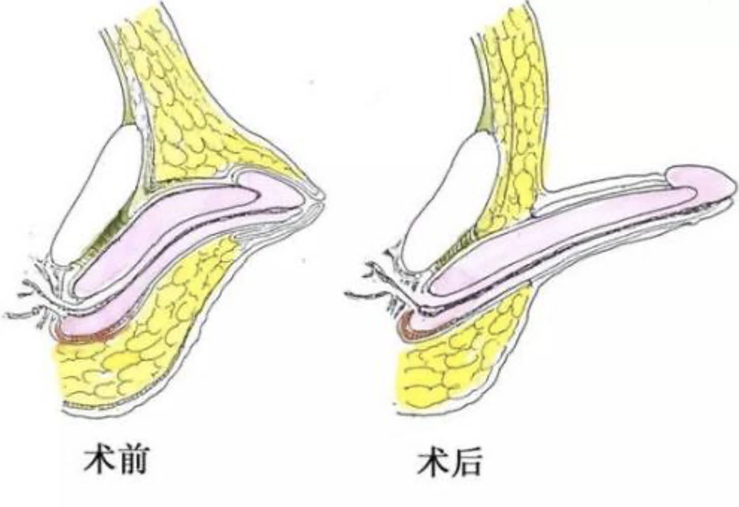 圖文圖片