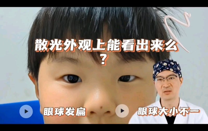 散光外观上能看出来么？