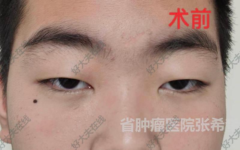 圖文圖片
