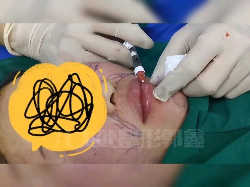 視頻封面