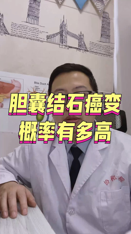 胆囊结石癌变概率有多高＃胆囊结石 ＃胆囊癌