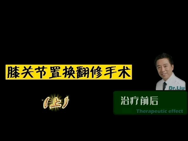 膝关节翻修手术（上）