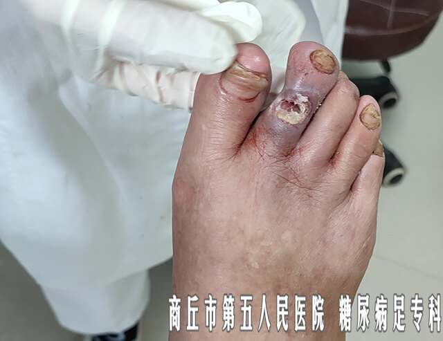 圖文圖片