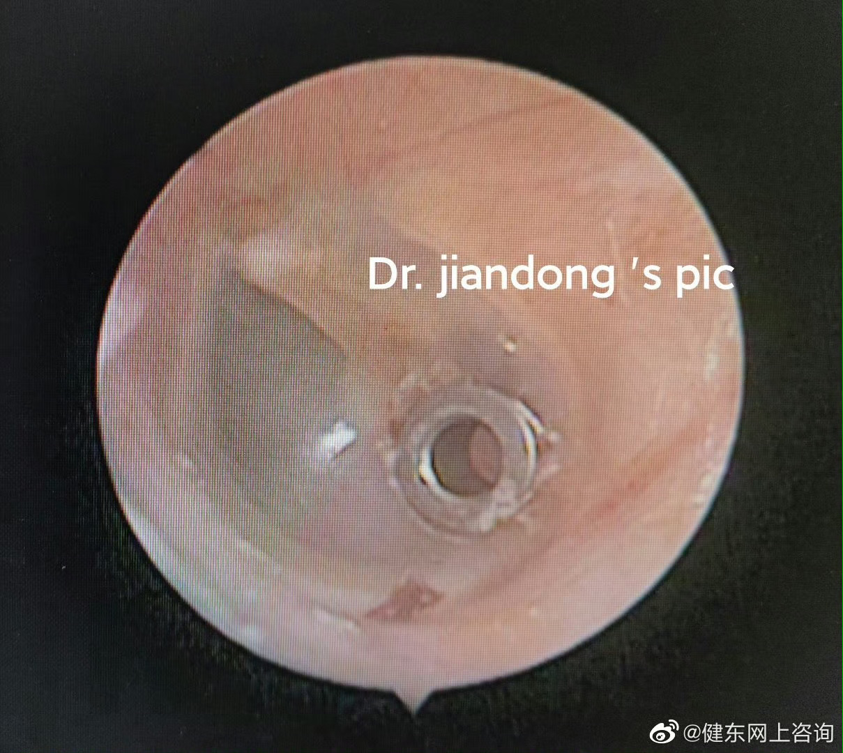 圖文圖片