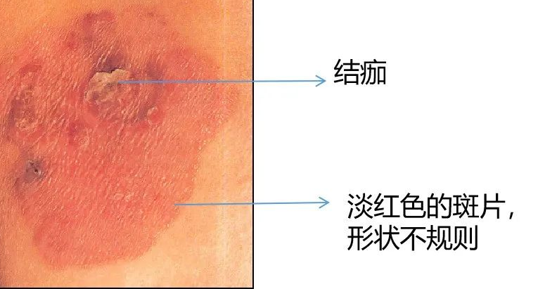 圖文圖片