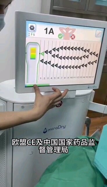 微波治疗腋臭！无伤口，无瘢痕！