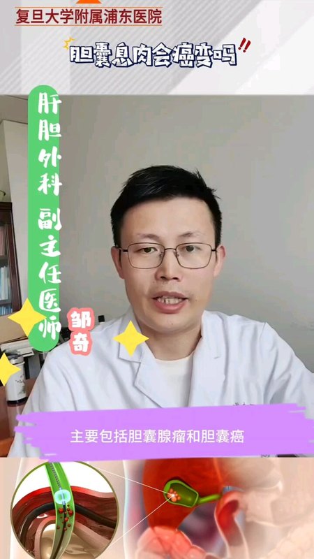 胆囊息肉会癌变吗