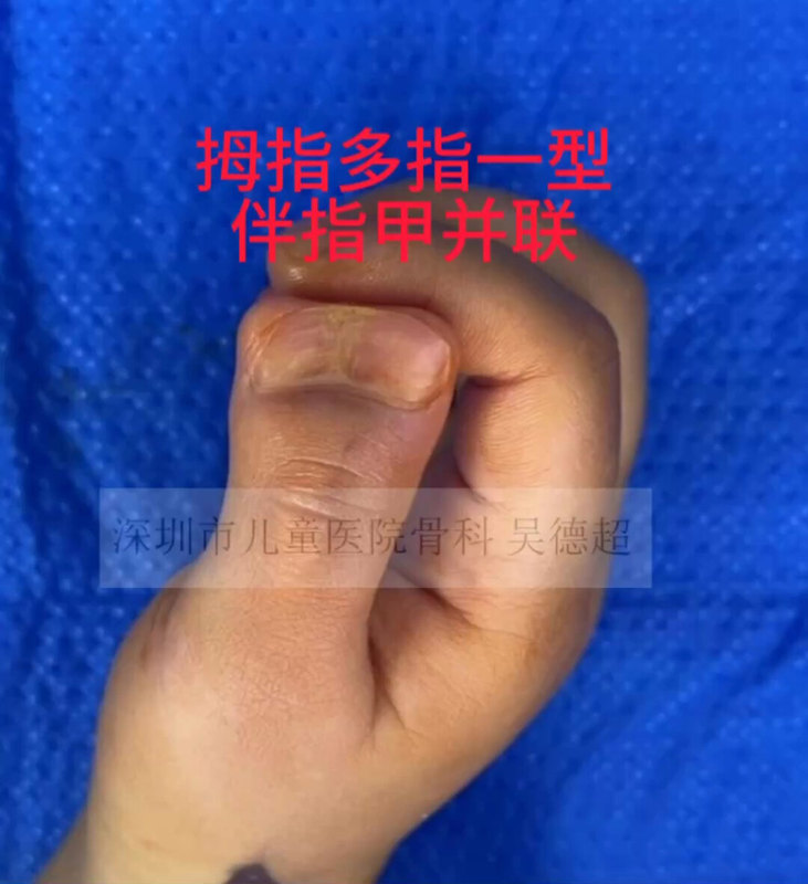 視頻封面