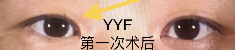 圖文圖片