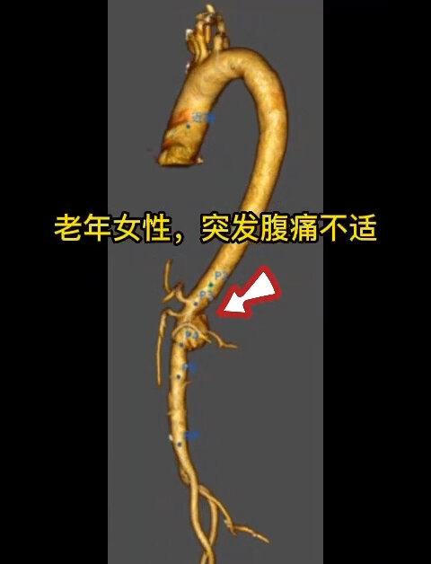 視頻封面