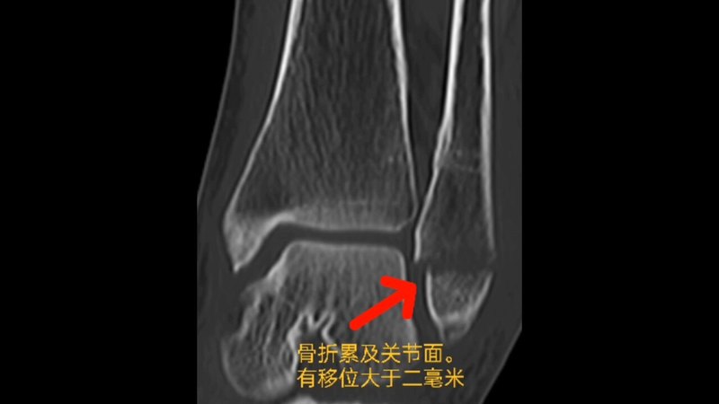 視頻封面