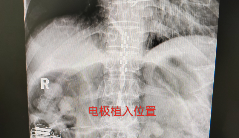 圖文圖片