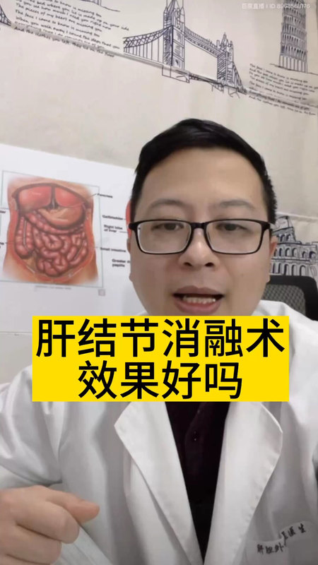 肝结节消融术效果好吗＃医学科普 ＃肝结节