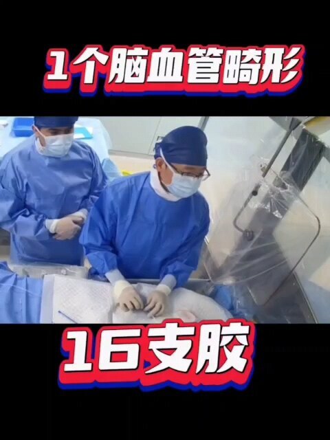 脑血管畸形栓塞治愈