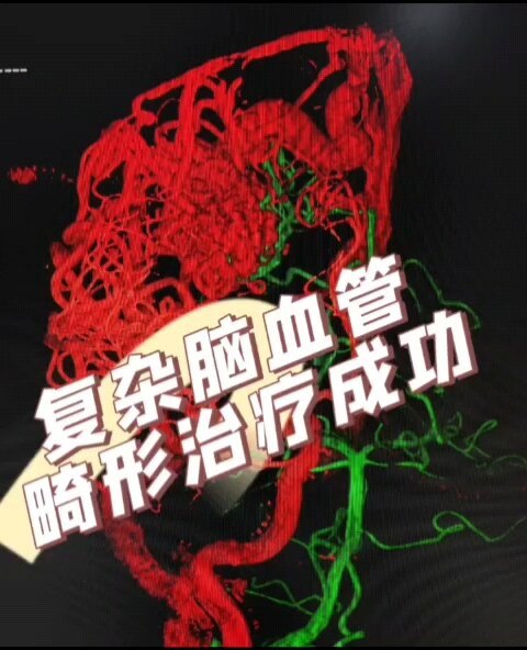 視頻封面