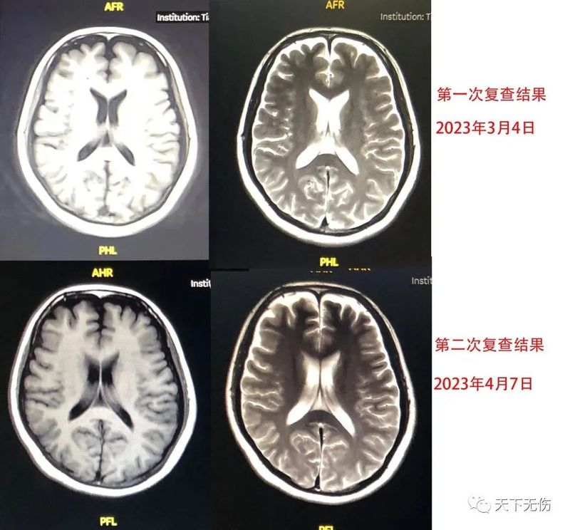 圖文圖片