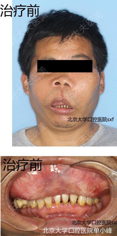 圖文圖片