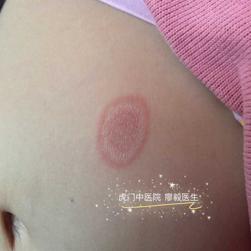 圖文圖片