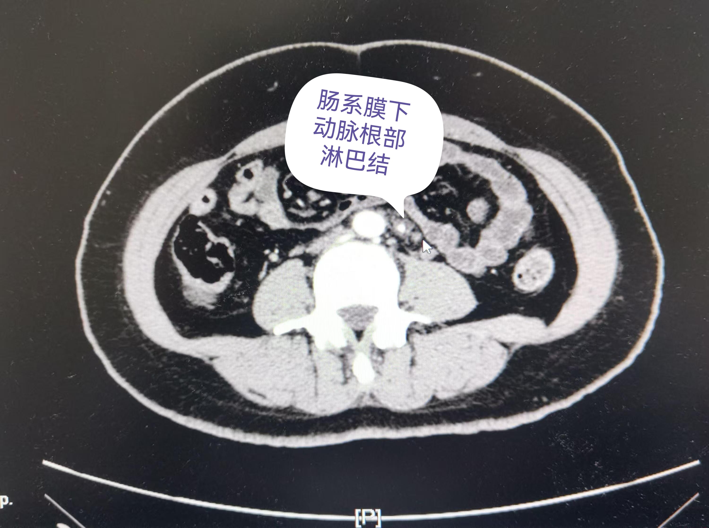 圖文圖片