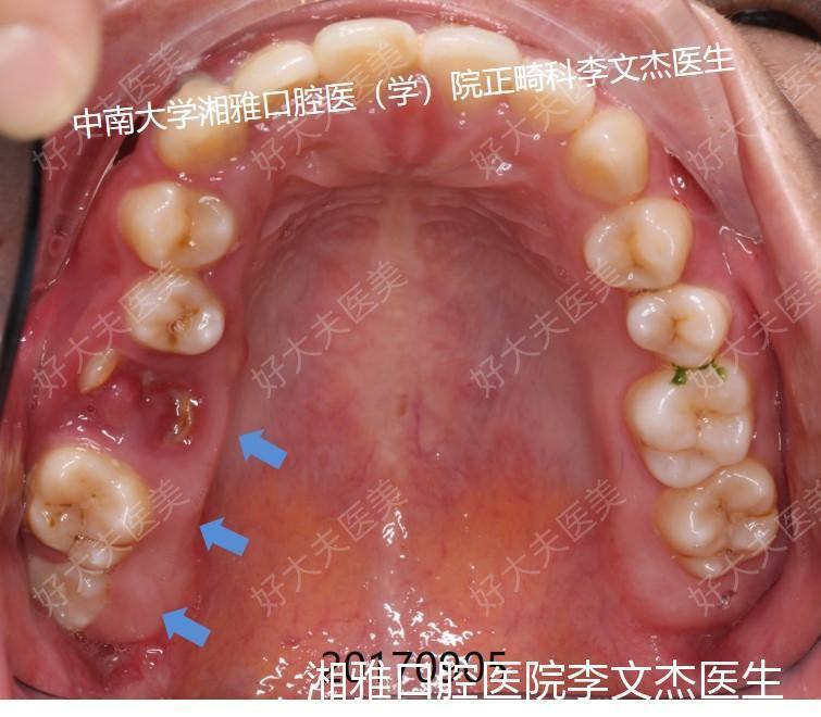 圖文圖片