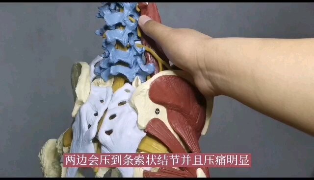 臀上皮神经卡压综合症的症状？