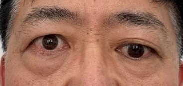 圖文圖片