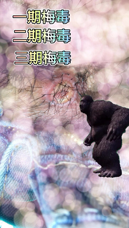 梅毒长咋样