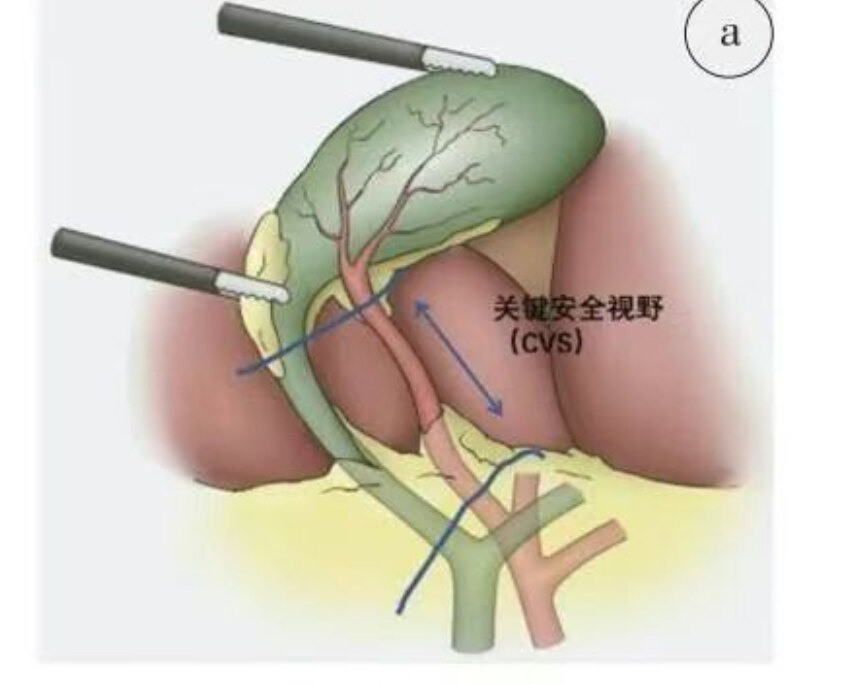 圖文圖片
