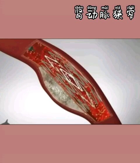 視頻封面