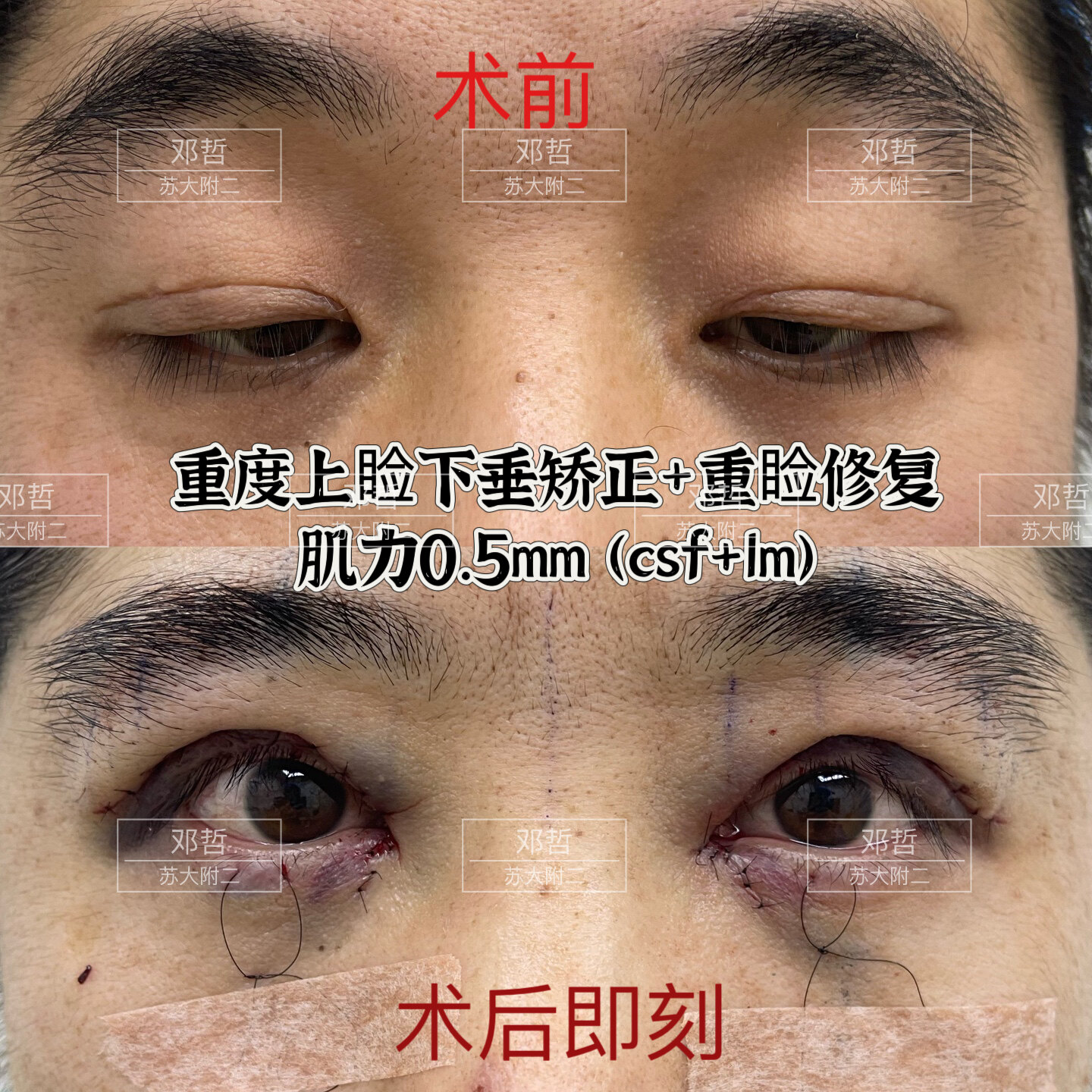 圖文圖片