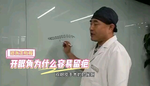 很多朋友会质疑，为什么内眦赘皮矫正术留疤的几率比重睑形成术更大呢？今天我们来说说内眼角的那些事。
