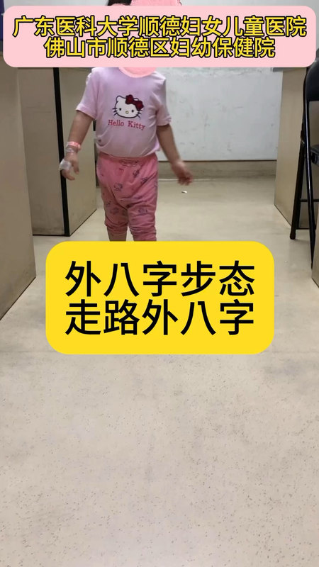 外八字步态，走路外八字。