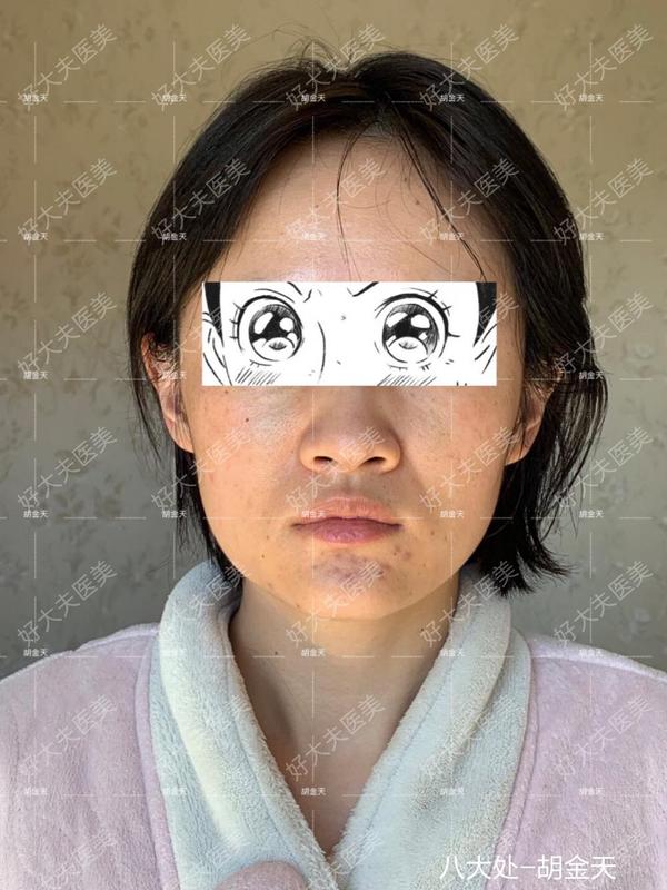 圖文圖片